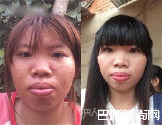 越南女子花十万整容闪婚嫁给富二代 之前真的太丑了！
