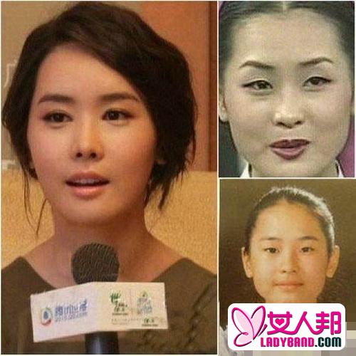 曝韩国女星整容变脸对比照：李多海尹恩惠变化惊人
