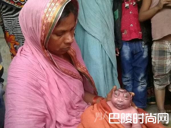 猴神哈奴曼转世？印度女子生下无脑巨眼怪婴