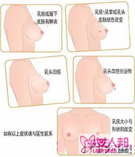 如何自检乳腺疾病呢 多注意多检查让你远离病痛