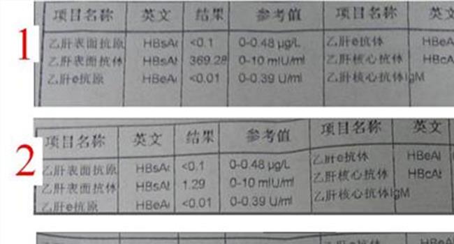 【乙肝六项是什么】乙肝六项是怎么回事?