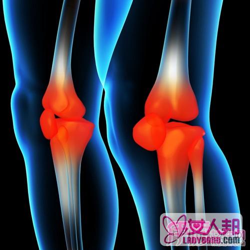 >膝关节内侧痛原因 其六大原因及预防方法
