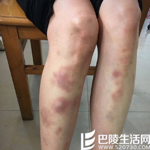 翻安柏伊微博 发现双腿淤血照,安柏伊个人资料