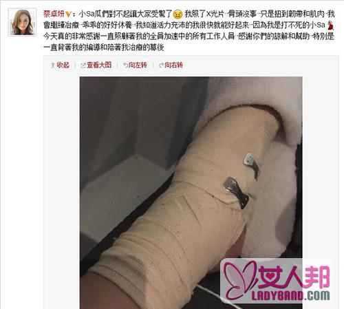 蔡卓妍受伤向粉丝致歉 感谢工作人员照顾