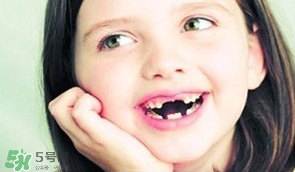 >小孩蛀牙牙痛怎么办 蛀牙牙痛如何止痛