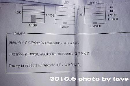 >让人纠结的唐氏筛查