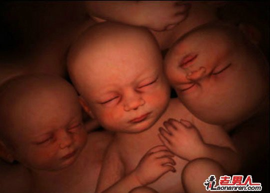 >拥挤在子宫里的双胞胎、多胞胎【图】