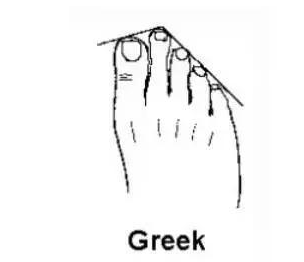 希腊脚穿什么鞋好看?尖头鞋适合希腊脚