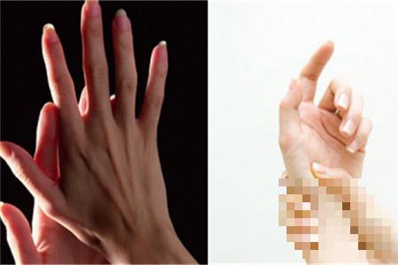 怎样才能瘦手指   哪些方法更有效