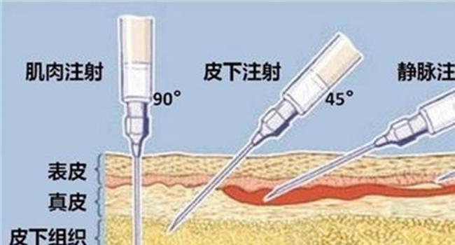 【皮肤皮下组织结构图】皮下组织有硬块