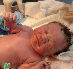 新生儿手握避孕环出生是怎么回事？出生后健康吗？
