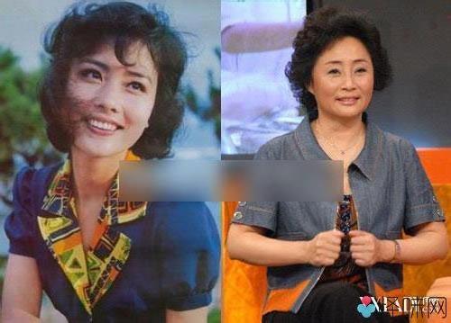 【杜志国赵娜为什么离婚】杜淳的母亲杨丽照片 杜淳父母杜志国杨丽为何离婚