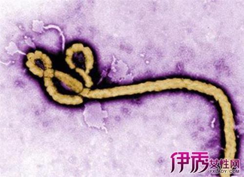 >【图】埃博拉病毒僵尸真假 揭秘融化活人的僵尸病毒