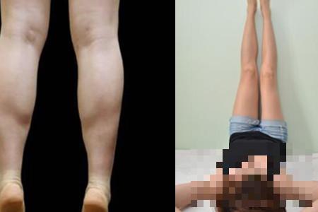 怎么减小腿备受女性关注 合理运动帮助大家甩掉赘肉