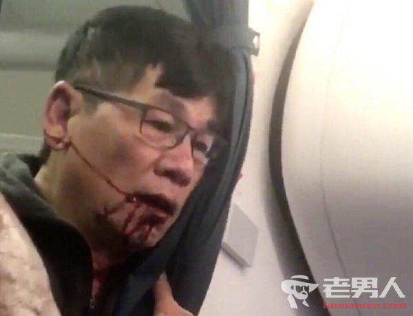 >美联航强制乘客下机 亚裔医生被打吐血
