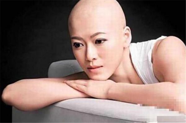 林淑敏乳腺癌切除了吗 曾因乳腺癌跌入低谷戴假发拍戏是真的吗
