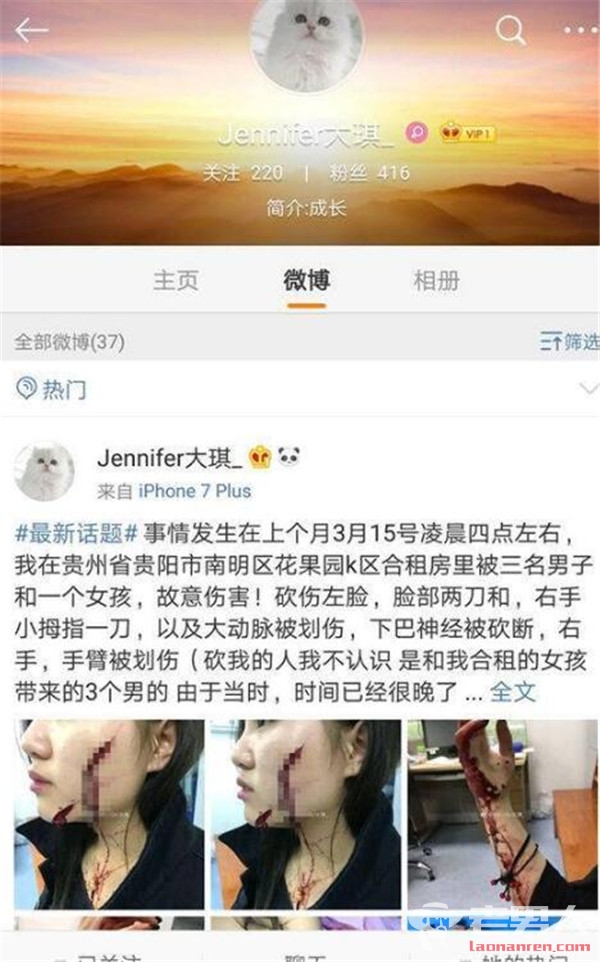 >女孩抗议室友遭砍 左脸被砍两刀缝了200多针