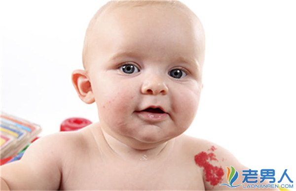 >胎记是怎么产生的 胎记位置影响着宝宝的命运
