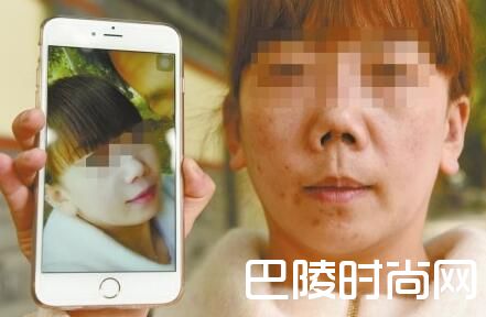 女子被整成朝天鼻 整容前后对比曝光惨不忍睹