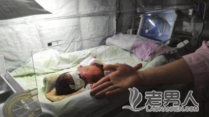 四川早产女婴仅700克 巴掌大下 被称“巴掌仙女”(图)