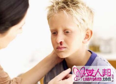 五岁小孩流鼻血是什么问题？  其四大病因需知道