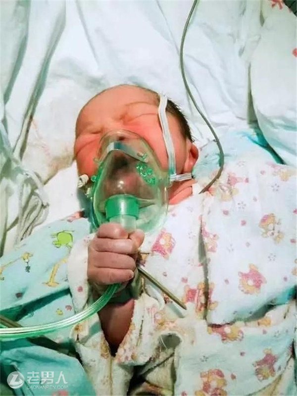 宝宝拿氧气罩吸氧 2017最励志宝宝诞生