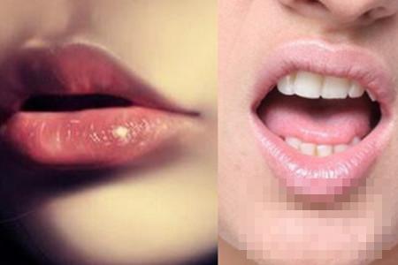 >为什么唇部有白色颗粒 这两个原因你猜到了吗