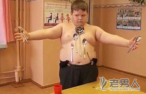 人肉磁铁！俄12岁男童触电后“无所不吸”