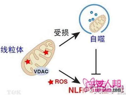 >炎症吃什么药比较有效 女性健康要及早提防炎症