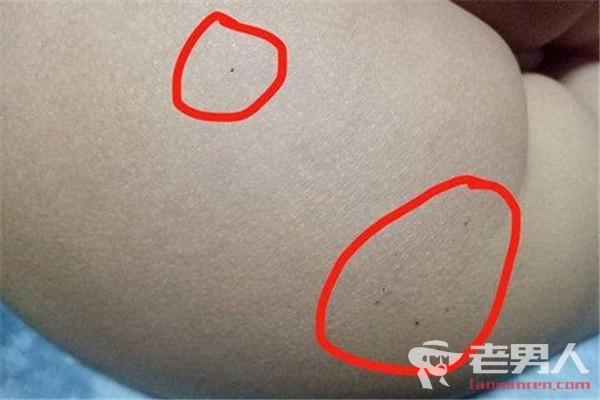 >北京红黄蓝幼儿园虐童事件背后真相 孩子遭扎针喂药片（图）