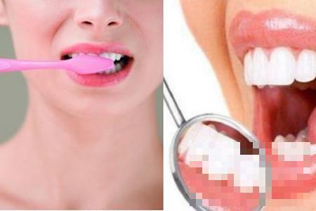 牙齿出血是什么原因 这些情况你考虑过吗