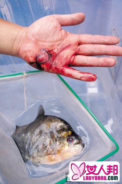 广西柳州惊险食人鱼袭人 两伤者手掌均血肉模糊