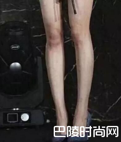 >【图】王鸥的腿没PS长这样左小腿现离奇长疤 盘点明星未ps腿杨幂最丑