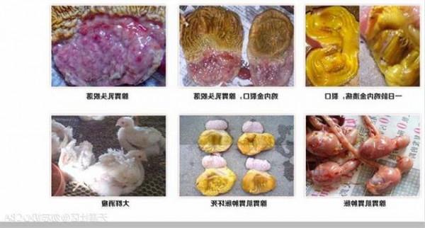 >干祖望治疗腺样体 案例一则:小儿扁桃体肿大和腺样体增大的诊治经验