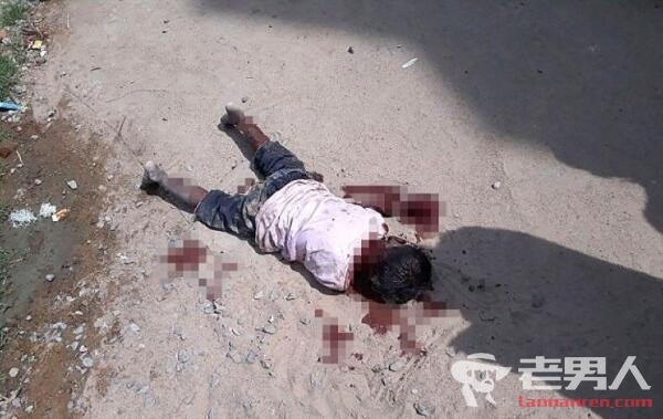 >印度4岁男孩遭野狗围攻身亡 邻居见死不救兴奋拍照