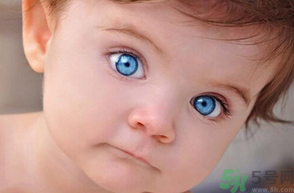 >宝宝得了红眼病怎么办？宝宝得了红眼病怎么治？