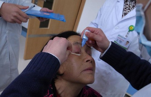 >怎样评价姚贝娜捐献眼角膜 眼角膜捐献条件有哪些