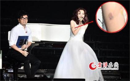 张靓颖摔下舞台 陈奕迅范玮琪蔡依林都曾在演唱会上受伤