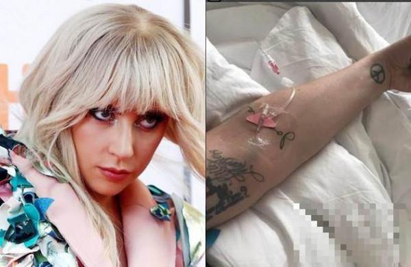 Gaga罹患纤维肌痛症紧急送医 得施打止痛针才能准备表演