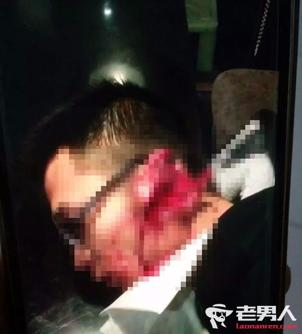 >扬州街头砍人事件 男子耳朵被砍伤势严重