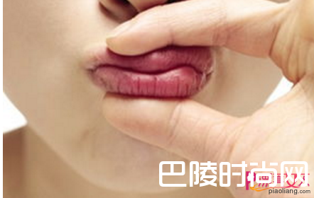 冬季嘴唇干裂的5大原因 护唇禁忌你知道多少？