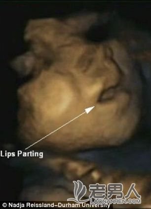 >3D扫描仪清楚看到胎儿做鬼脸（图)