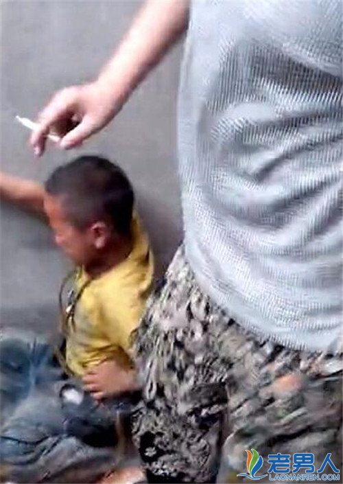 男童遭烟烫群殴 施暴者竟免担刑责