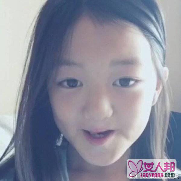 王菲10岁女儿李嫣兔唇修复明显变好，活泼可爱十分有范儿