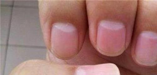 指甲半月痕透露健康 指甲上的半月痕与健康有何关联?