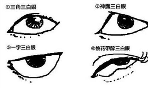 四白眼和三白眼区别 [眼白上有黄斑眼睛痛]象眼 四白眼 三白眼