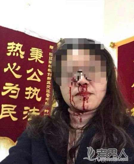 网曝苏州大学领导遭交警殴打 涉事辅警被停职
