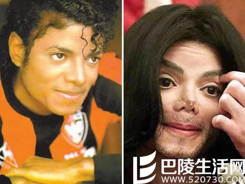 一代歌王迈克杰克逊整容失败 鼻子整容次数创世界纪录