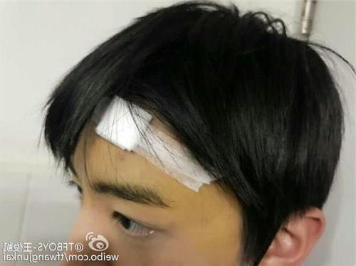 >杨肸子我们的少年时代 王俊凯受伤 新剧《我们的少年时代》杀青撞到门框