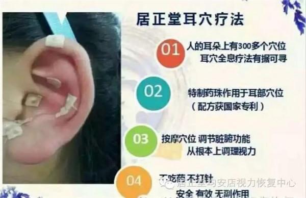 >上海居正 近视了200多度 听说居正堂在耳朵上贴上一些东西